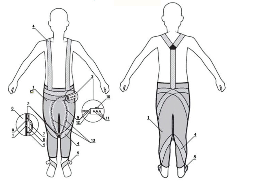 Joonis 2. Esialgse disainiga elastsete survekomponentidega retuusid. 1 – elastsest materjalist rõivaese; 2 – surve mehhanism; 3 – registraator; 4 – elastsest materjalist lindid, mis omavad pinguse reguleerimise vahendit; 5 – lindi pingust reguleeriv vahend; 6 – kehaosa; 7 – sfäärisegmendi kujuline surve suurust reguleeriv mehhanism; 8 – elektromehaaniline andur; 9 – juhtmed, mis ühendavad elektromehaanilisi andureid registraatoriga; 10 - lüliti; 11 - valgus- või heliindikaatorid; 12 - juhtmete 9 pistikupesad; 13 – taskud juhtmetele ja anduritele.