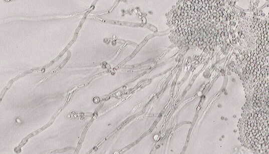 Candida albicans